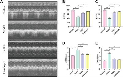 Xin-Ji-Er-Kang protects heart from ischemia-reperfusion injury by rebalancing lipid metabolism